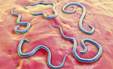 Roundworms